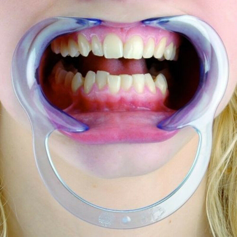 10 Pcs Mouth C Shape Opener Dental Cheek Retractor Fun Game Watch Large Size L